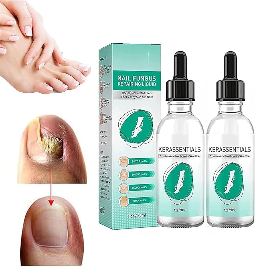 Kerassentials Toenail Fungus Treatment Oil, Kerassentials For Toenail Fungus, Kerasentials Nail Treatment, Nail Repair Kit For Broken Natural Nails, Damaged & Discolored Toe Nails (2pcs) : Amazon.co.uk: Beauty